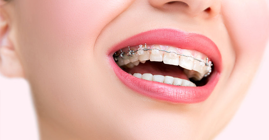 orthodontic-treatment